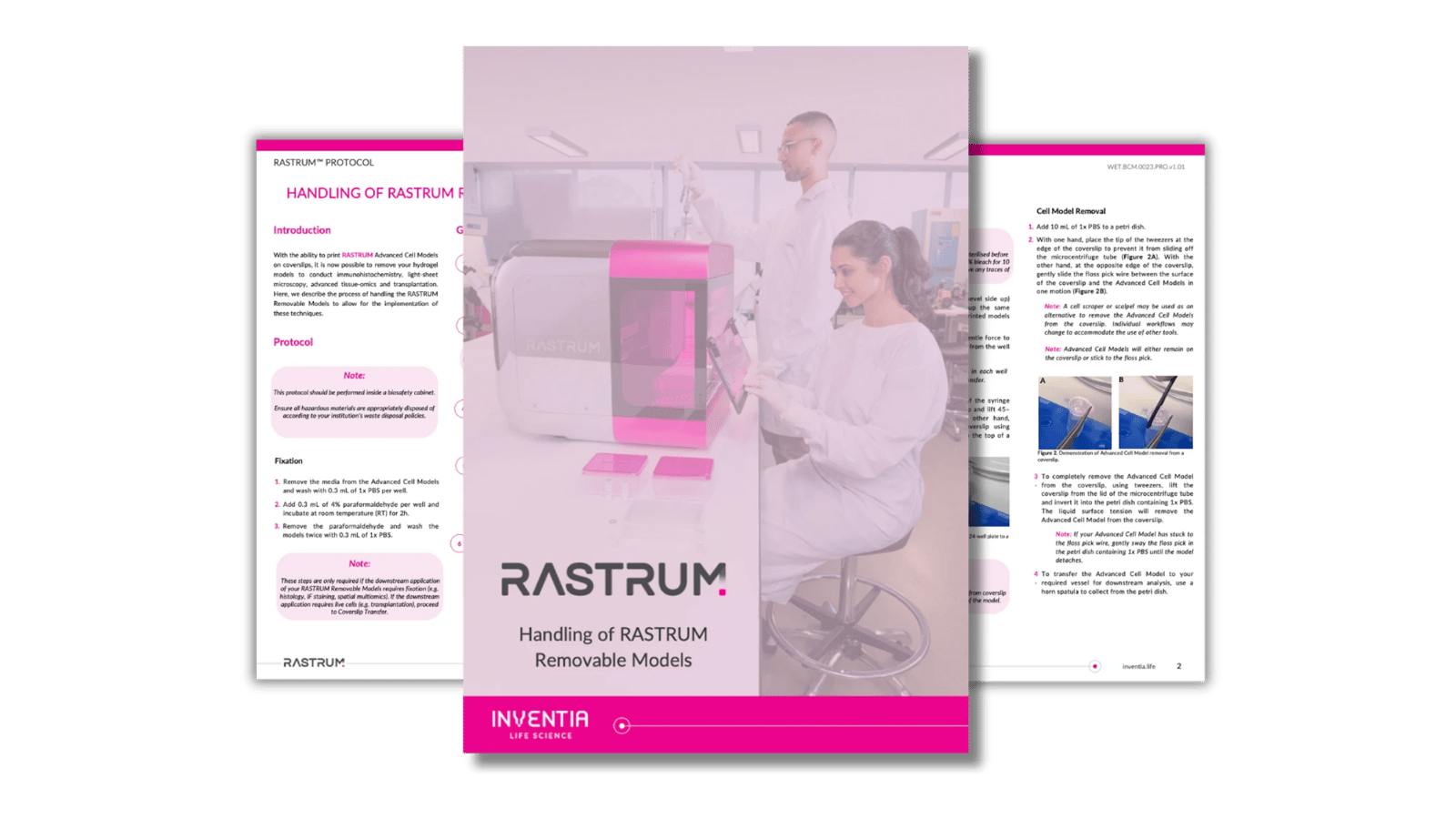 Handling RASTRUM™ Removable Models