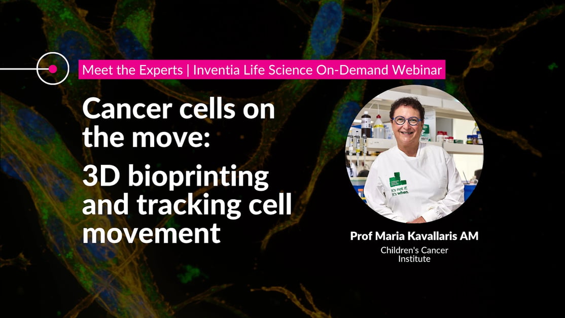 Cancer cells on the move: 3D bioprinting and tracking cell movement