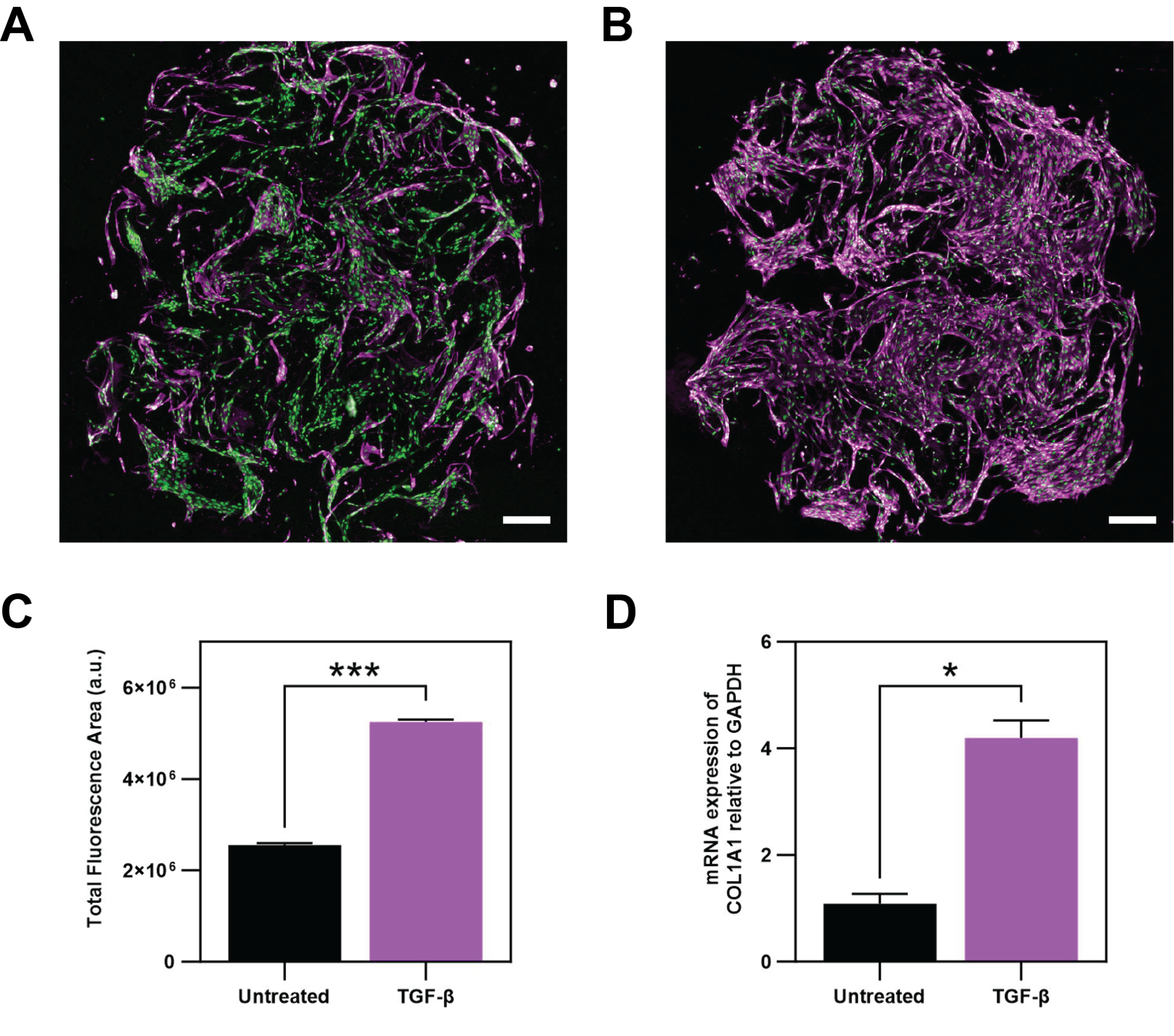 Untreated and TGF-beta-treated NHLF 3D models showing increased collagen I staining and COL1A1 expression after treatment.