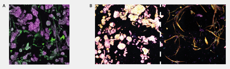 NHLF and A549 lung cancer cell cocultures in a direct Imaging Model and a spatially separated Dual Matrix Model.