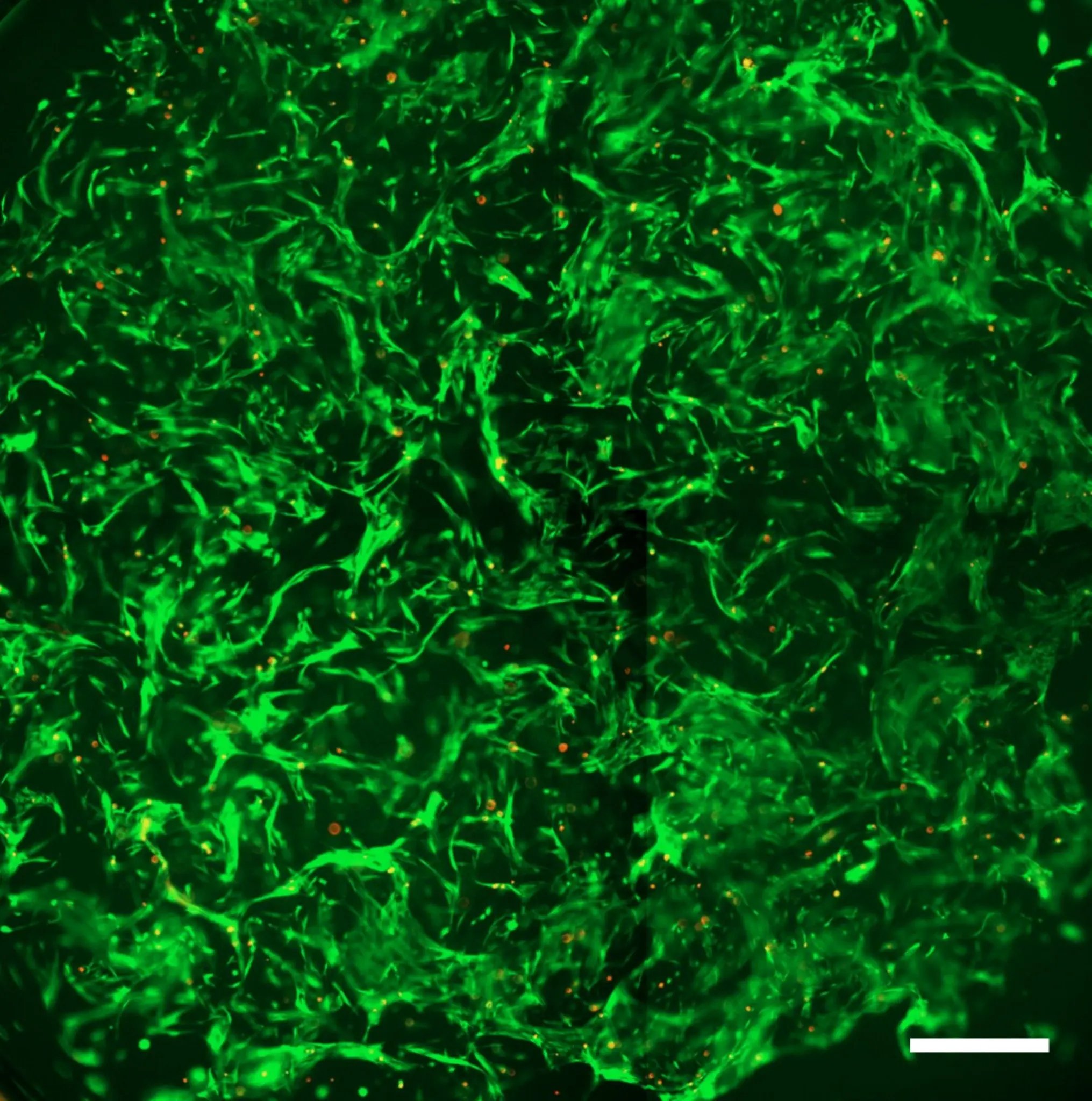TGF-β–induced αSMA expression in fibroblasts cultured in RASTRUM matrices, showing 3.2-fold activation at 72 hours