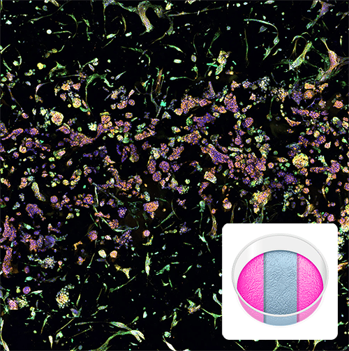 Fluorescent microscopy image of tumor-fibroblast cell interactions in a RASTRUM Triple Matrix Model. Cells stained for nuclei (blue), endoplasmic reticulum (green), and actin (yellow) show interactions across three distinct matrix compartments. Inset displays a schematic of the Triple Matrix Model.