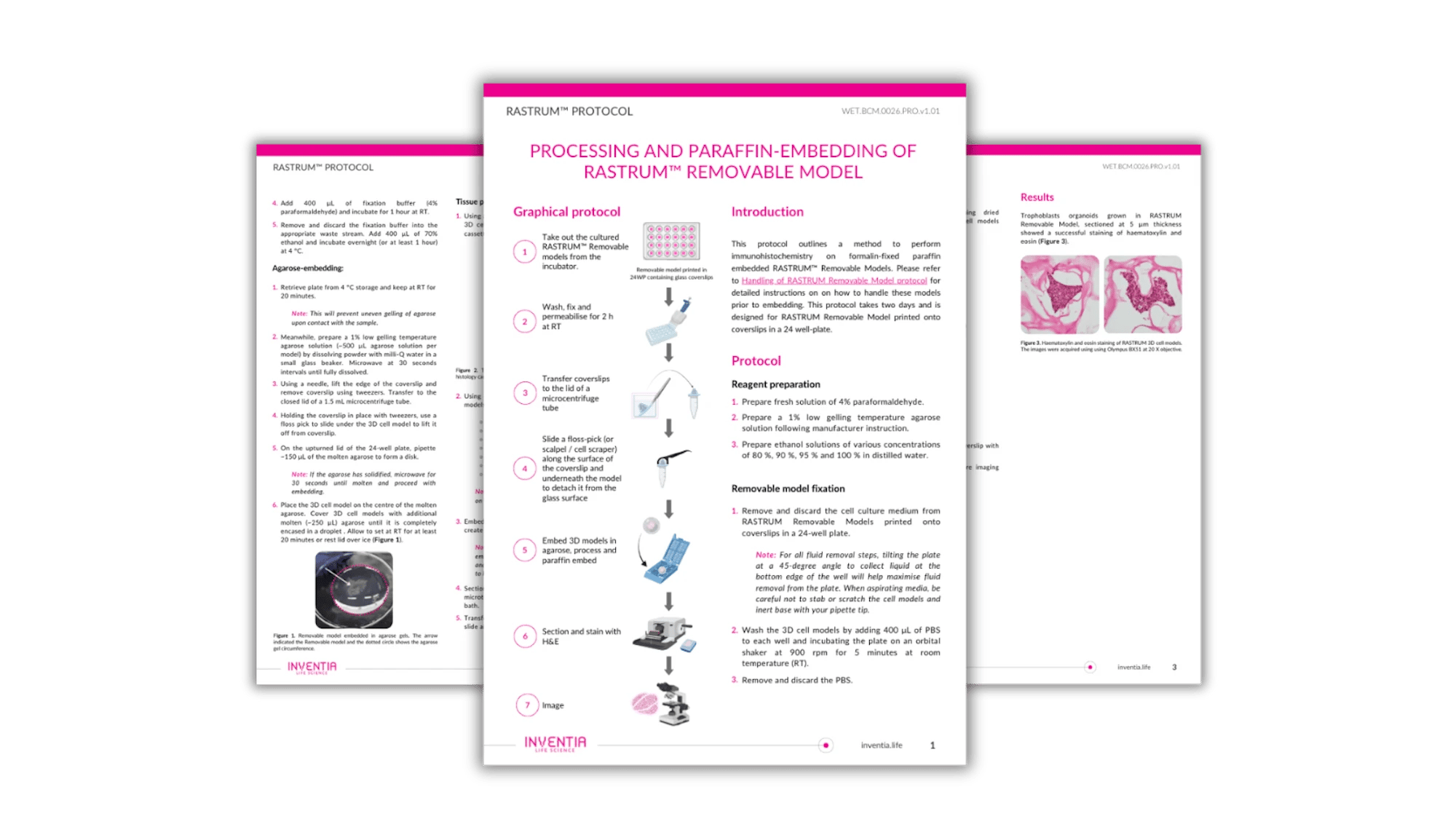Processing and Paraffin-Embedding of RASTRUM™ Removable Model