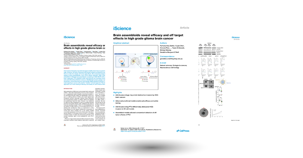 Brain assembloids reveal efficacy and off target effects in high grade glioma brain cancer
