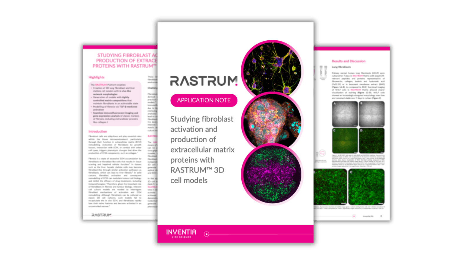 Studying fibroblast activation and production of extracellular matrix proteins with RASTRUM™ 3D cell models