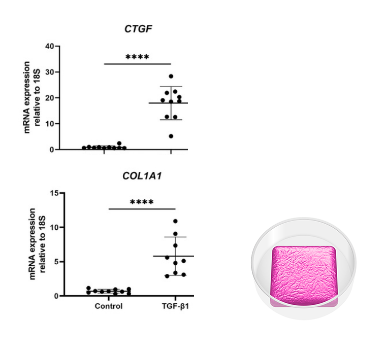 Graph showing increased gene expression of COL1A1 and CTGF in a liver co-culture model created with RASTRUM after TGF-β1 treatment. Inset displays a schematic of the Large Plug Model, optimized for bulk cell analysis and high data yield in DNA, RNA, and protein studies.