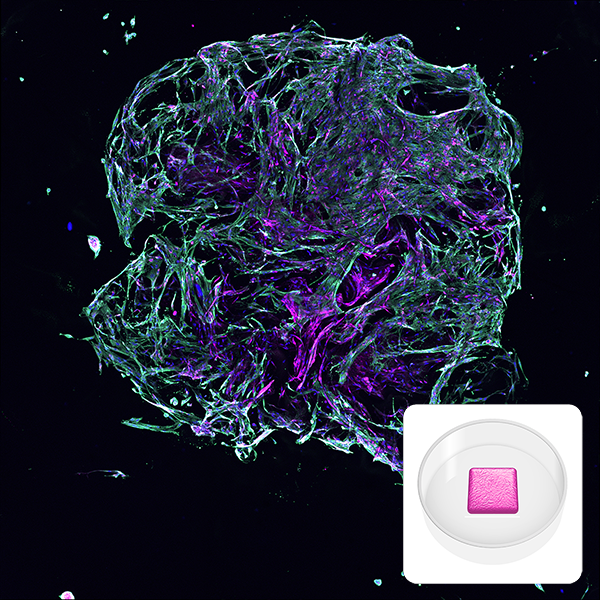Fluorescent microscopy image of a lung fibroblast model printed with RASTRUM, showing collagen (magenta), actin (green), and cell nuclei (blue). Inset displays a schematic of the Imaging Model architecture, optimized for high-content imaging and minimal cell usage.