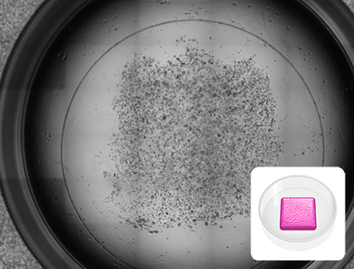 Black and white microscopy image of an MCF-7 cancer cell culture printed in a RASTRUM Removable Model within a 24-well plate, designed for implantation and downstream analyses. The coverslip enables easy removal of the intact matrix. Inset shows a schematic of the Removable Model architecture.