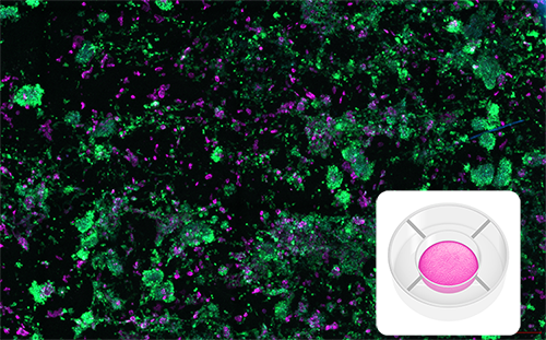 Fluorescent microscopy image of an immuno-oncology model using RASTRUM Mematix Model, showing CD45+ immune cells (green) interacting with Pan-CK+ cancer cells (magenta) after six days. Designed for migration and signaling studies. Inset displays a schematic of the Mematix Model architecture.