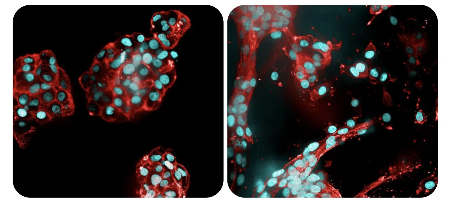 Fluorescent microscopy images of U-87 glioblastoma cells grown in RASTRUM™ matrices. Left: cells in the absence of Fibronectin adhesion peptide (RGD). Right: cells with RGD, showing branched, spindle-like morphology—mimicking the invasive glioblastoma phenotype. Nuclei (blue), actin (red).