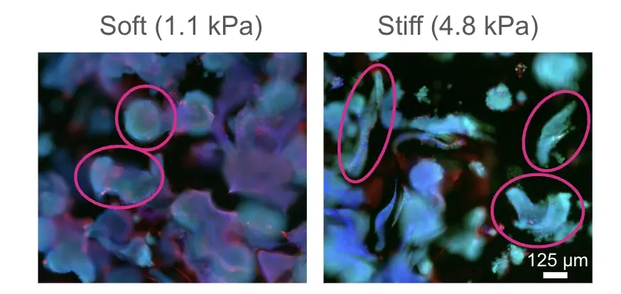 Comparison of ovarian cancer cell morphology in soft (1.1 kPa) vs. stiff (4.8 kPa) RASTRUM™ Matrices. Fluorescent staining shows cell nuclei (blue), live cells (green), and dead cells (red). Increased stiffness led to a transition from round to elongated morphology, highlighting ECM stiffness effects on cell behavior.