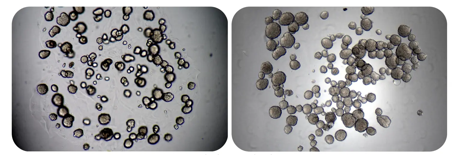 Tumor spheroids in RASTRUM™ Matrix before (left) and after (right) adding RASTRUM Cell Recovery Solution. The degradation of the matrix allows the released spheroids to settle in a single focal plane, enabling downstream applications such as single-cell sequencing and flow cytometry.