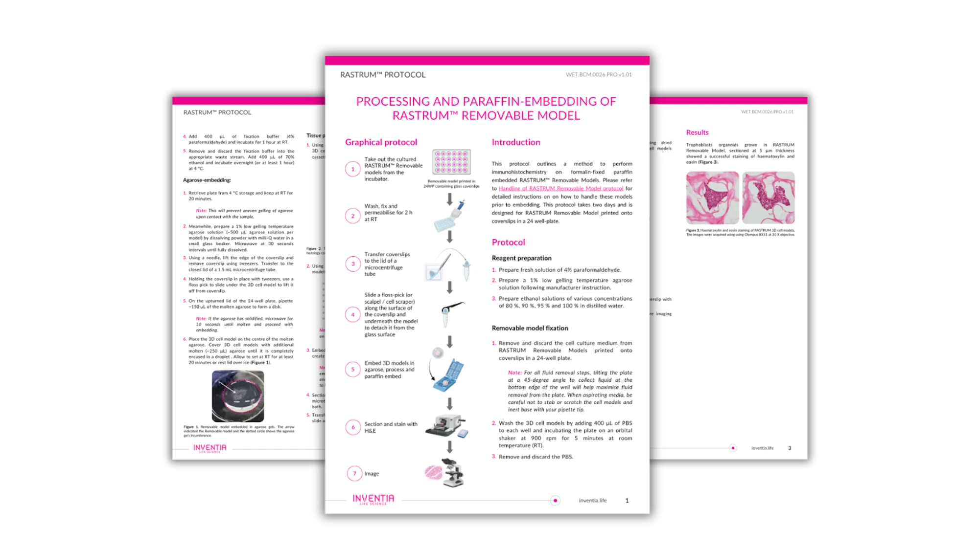 Processing and Paraffin-Embedding of RASTRUM™ Removable Model
